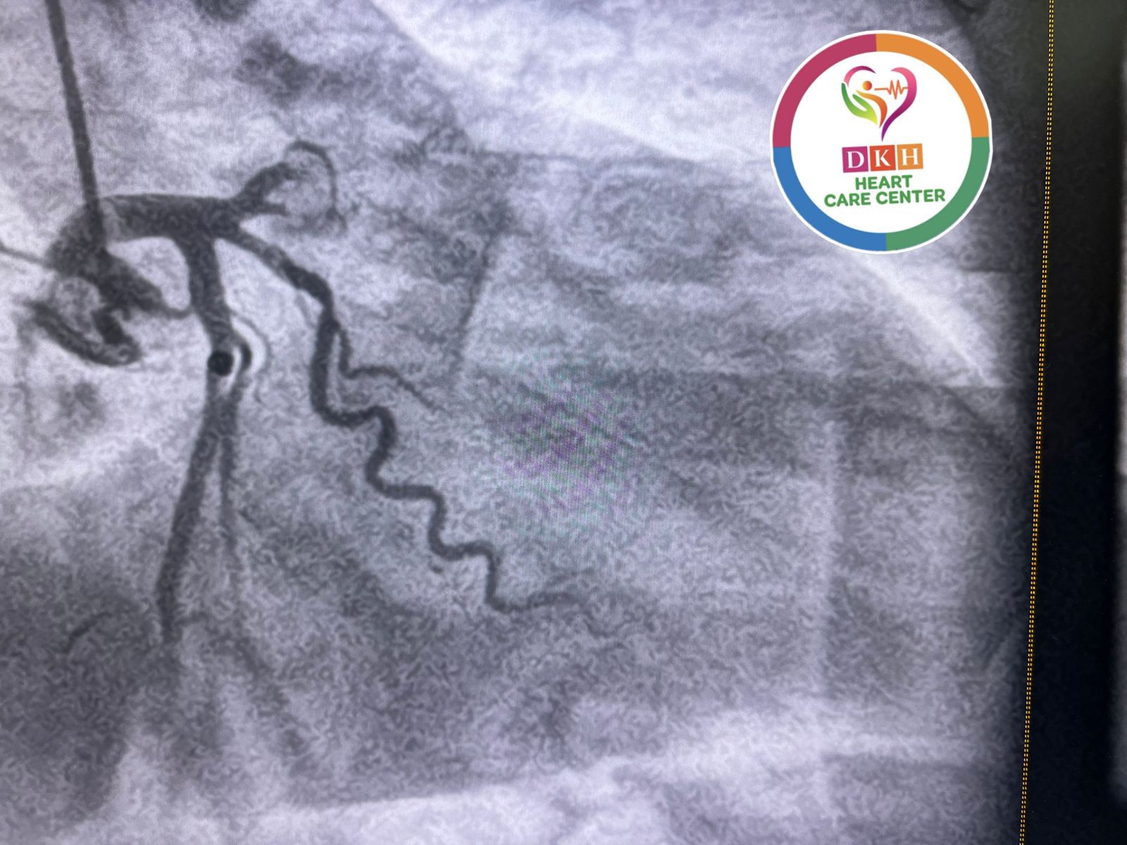 Medical Angiogram Image 6